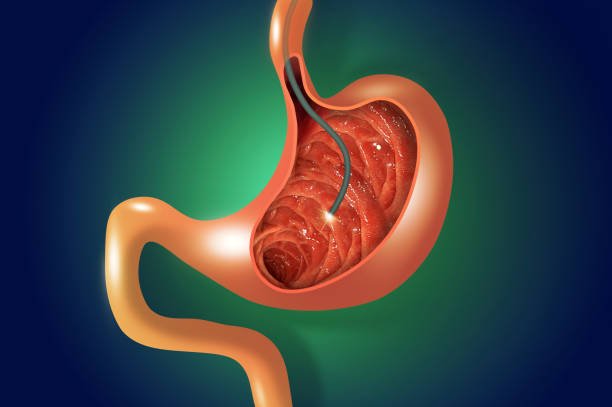 Gastroscopy