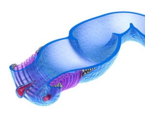 anal fissure surgery