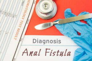 anal fistula surgery in Singapore